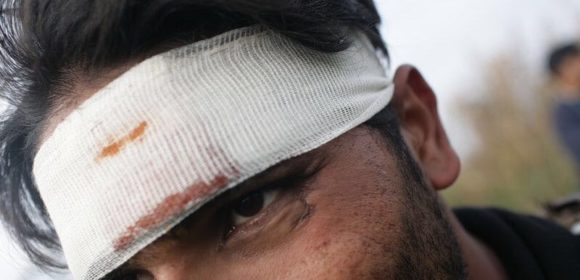 man with bloody bandaged head