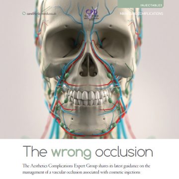 The Wrong Occlusion