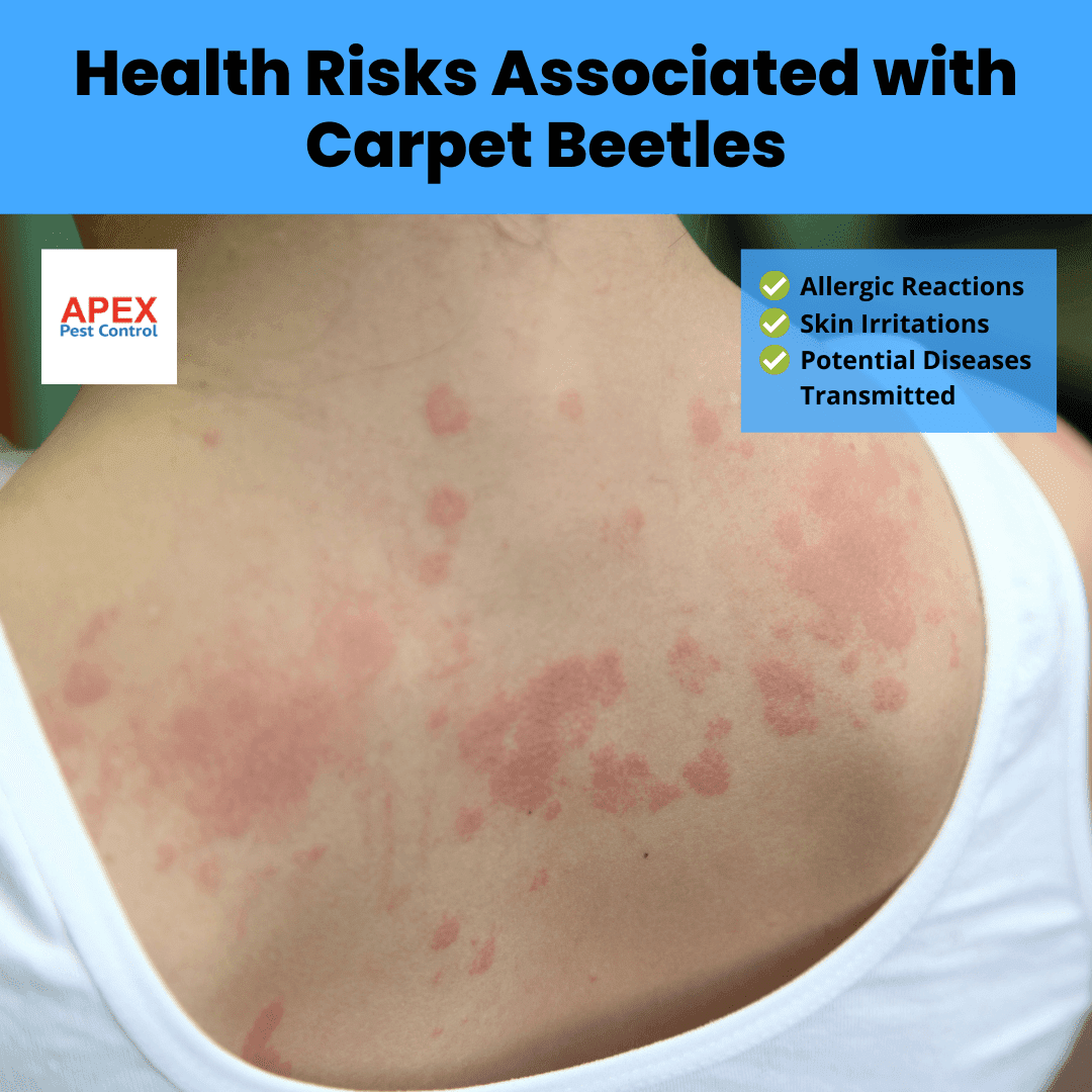 Health Risks Associated with Carpet Beetles