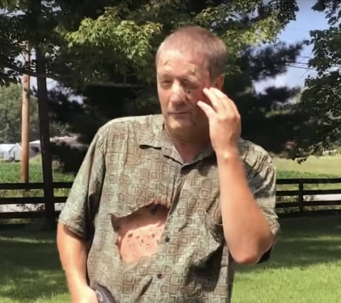 pest control wasps dangerous man stung