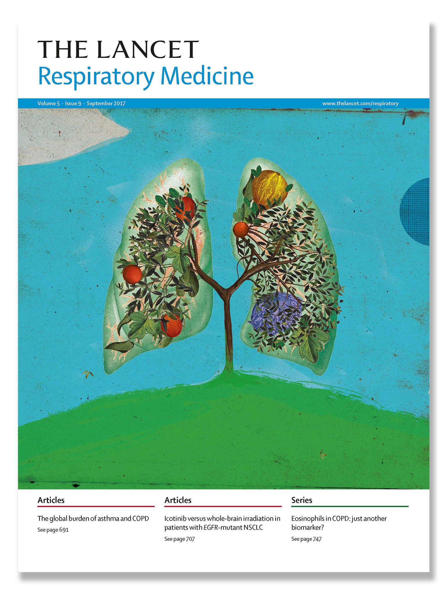 The Lancet Respiratory Medicine BARRY FALLS Heart Agency