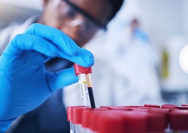 Hepatitis C home-tests ordered by 100,000 people