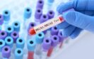 A gloved hand holding a test tube blood sample with a label saying BRCA1/BRCA2 test on a background of test tubes to illustrate in vitro advances in predicting resistance to PARP inhibitors for BRCA1/2 mutations