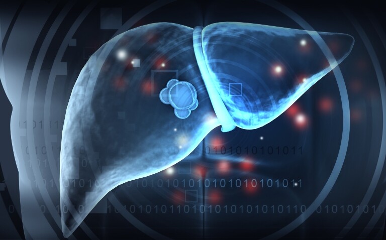 Targeted follow-up and treatment strategies advised for colorectal liver metastases, study finds