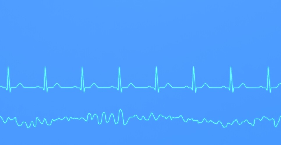Consider increasing potassium levels to reduce ventricular arrhythmia risk, study suggests