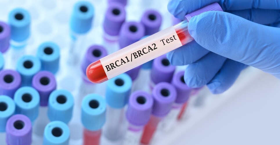 A gloved hand holding a test tube blood sample with a label saying BRCA1/BRCA2 test on a background of test tubes to illustrate in vitro advances in predicting resistance to PARP inhibitors for BRCA1/2 mutations