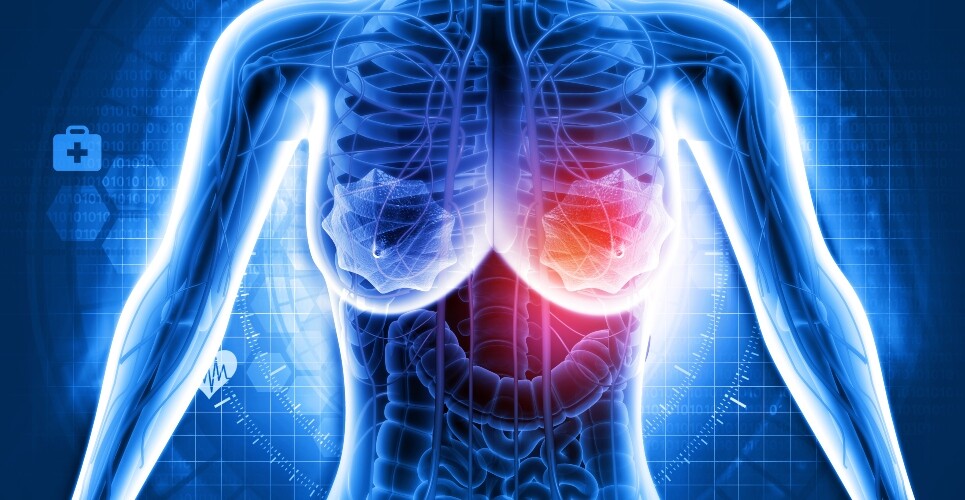 Medical illustration of a female upper body with visible internal organs, highlighting the left breast area in red to represent breast cancer and the impact of early CDK4/6 inhibitor use on survival and toxicity