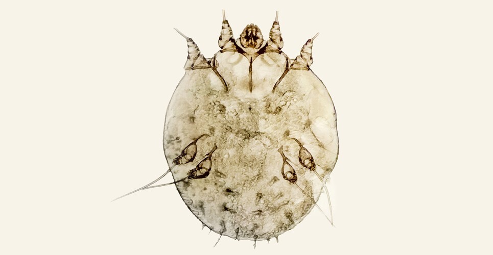 Increasing ivermectin dose offers no benefit in severe scabies, evidence suggests