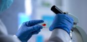 HIV diagnoses fall by 4% across UK