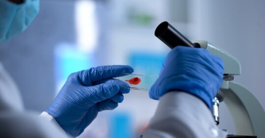 HIV diagnoses fall by 4% across UK