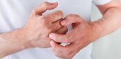 NICE recommends new treatment option for chronic hand eczema