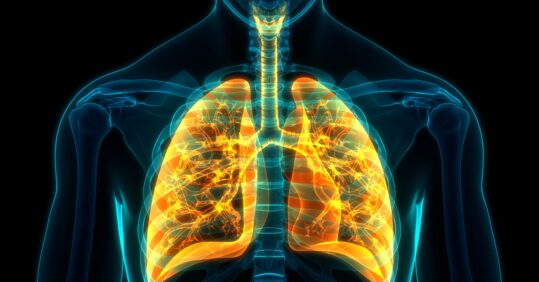 NICE approves first targeted treatment for uncontrolled COPD