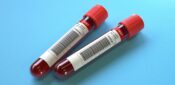 NICE proposes new age thresholds to guide ovarian cancer referral