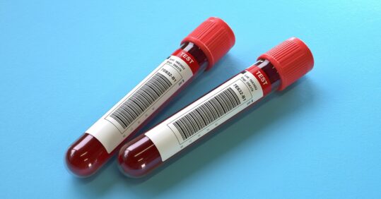 NICE proposes new age thresholds to guide ovarian cancer referral