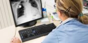 Vitamin D deficiency linked to higher risk of hospitalisation for respiratory infections
