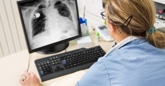 Vitamin D deficiency linked to higher risk of hospitalisation for respiratory infections