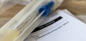 Bacterial and fungal vulvo-vaginal infections – how to recognise and manage them   