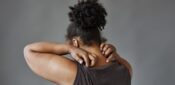 How to recognise and treat eczema in skin of colour