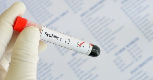 Syphilis cases rising worldwide: what nurses need to know