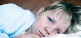Two children have died from measles in England this year, new UKHSA data shows