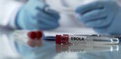 Nursing staff ‘at risk’ amid Ebola outbreak, warns RCN          
