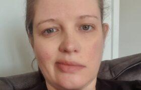 Clinical conundrum: Managing a patient with Bell’s palsy