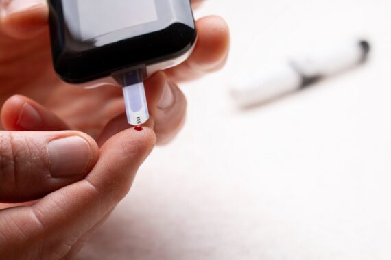 Type 2 diabetes guideline shake-up to see first-line SGLT-2 prescribing