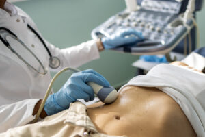 Sponsored CPD: Diagnosis and management of primary biliary cholangitis
