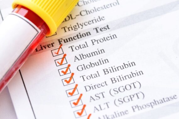 How to investigate an isolated elevated ALT – a rational testing approach