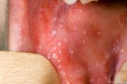 Challenges in paediatric infectious disease: A primary care update 