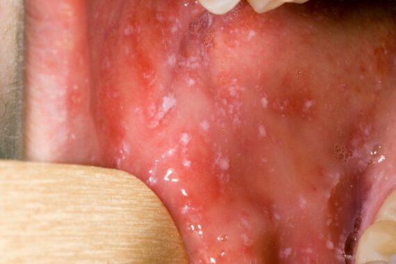 Challenges in paediatric infectious disease: A primary care update 