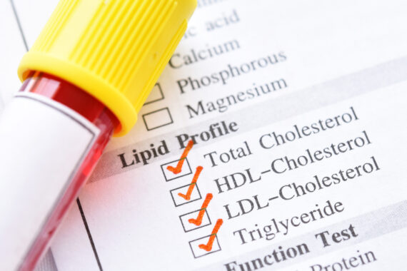 How should I advise a patient on the pros and cons of inclisiran?