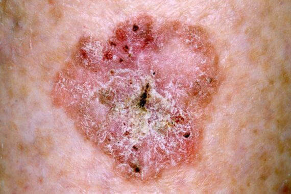 Top ten advice and guidance requests in dermatology
