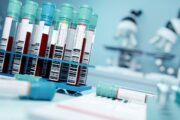 When raised potassium may be a false flag – how pseudohyperkalaemia unmasked thrombocytosis
