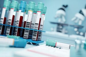 When raised potassium may be a false flag – pseudohyperkalaemia unmasking thrombocytosis