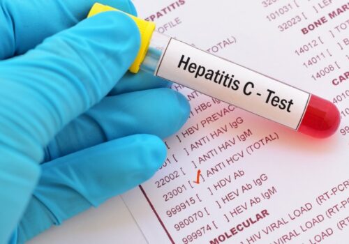 hep c