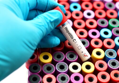 Hepatitis C testing in community pharmacies ‘cure more likely’, study finds
