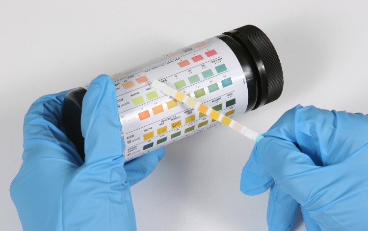 This is a urine dipstick being read by a medical professional. This test would be used to determine the presence of several medical conditions