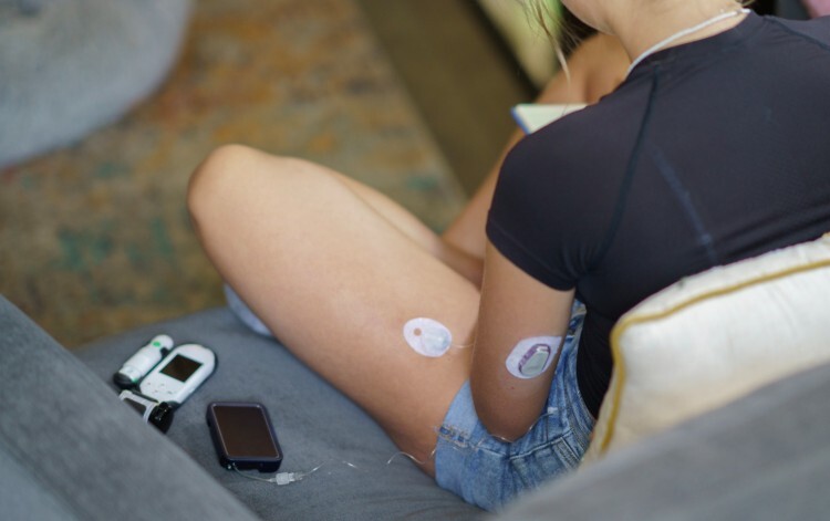 Woman managing her diabetes with an insulin pump and CGM