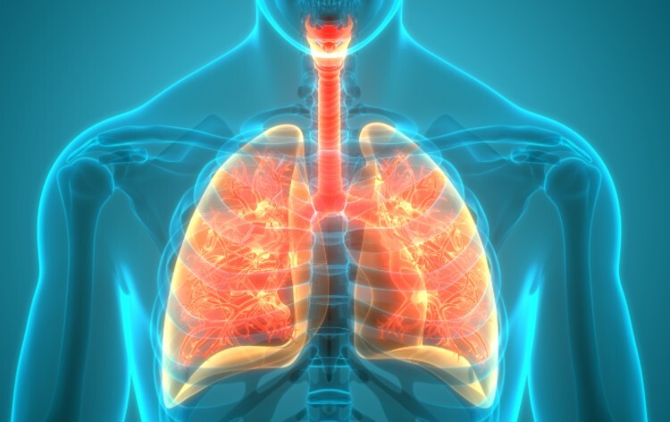An X-ray image of the lungs