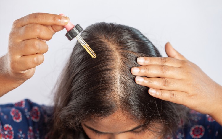 Woman using minoxidil