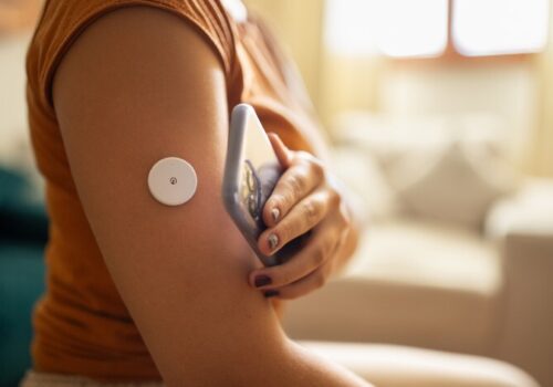 Continuous glucose monitoring