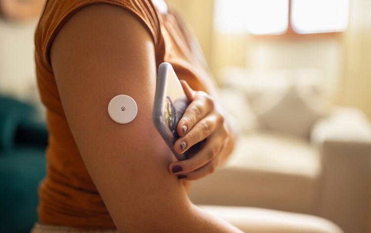 Continuous glucose monitoring