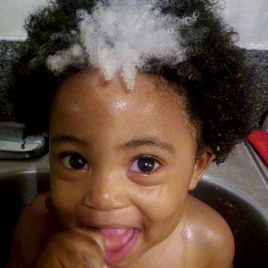 Baby Inherits Rare White Patch Of Hair That Goes Generations