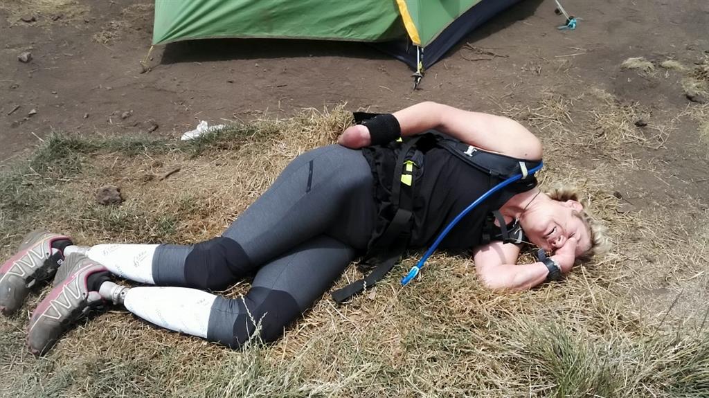 Tough going: Corinne feels the pain after climbing in her prosthetics