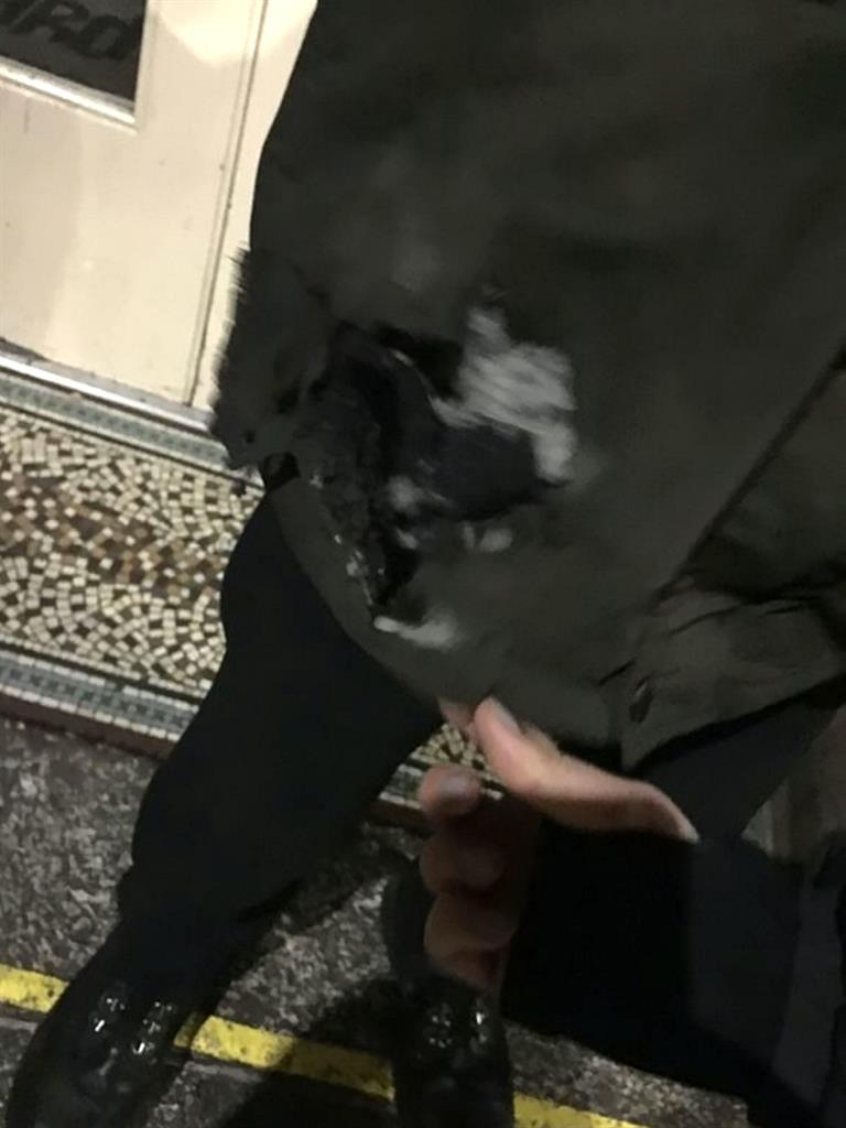 Hole in his pocket: The man claims a wallet saved his leg from worse injury