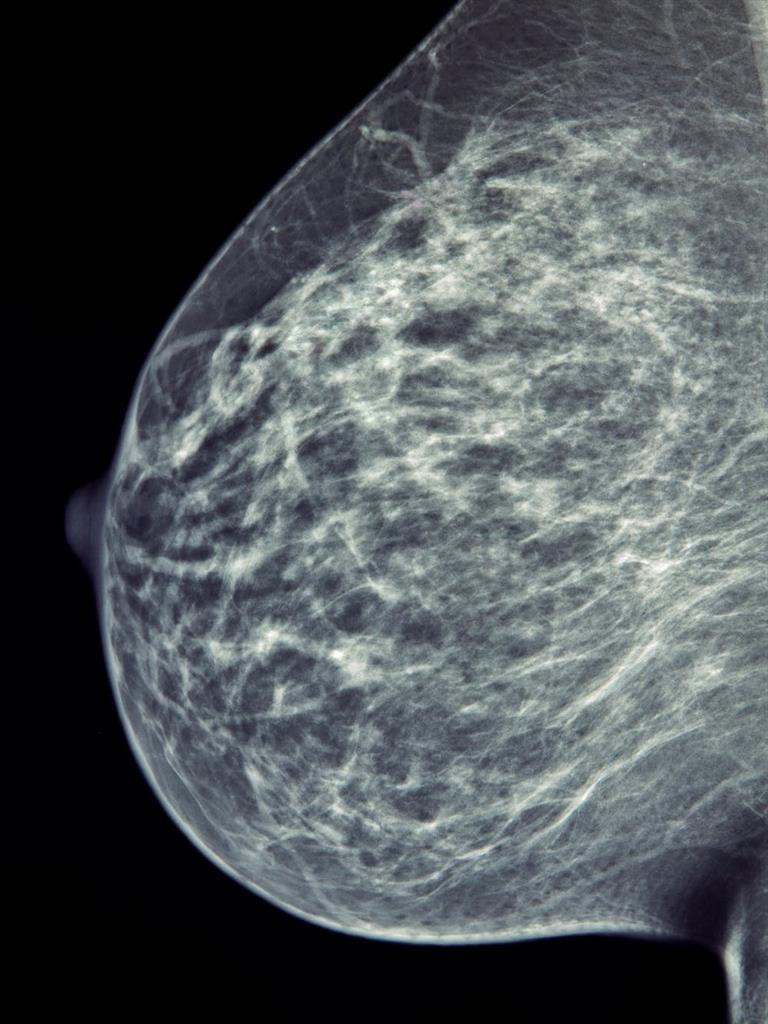Screening: Humans need years of training, practice and experience to diagnose cancer from mammograms PICTURE: MARK KOSTITCH/SHUTTERSTOCK
