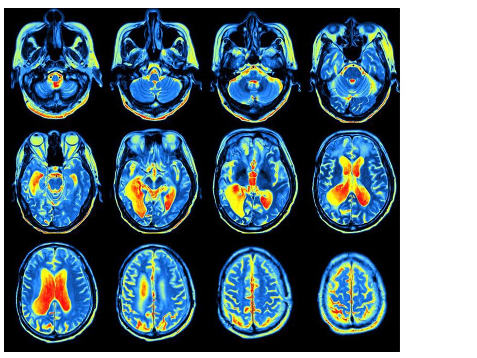 Reading: It literally changes the brain PICTURE: MriMAN