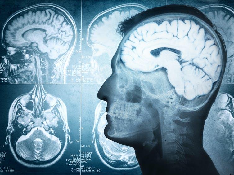 Behaviour: Our brains can reveal a lot about it PICTURE: TRIFF