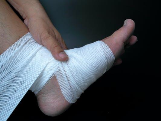 On the mend: Compression is an important part of the healing process PICTURE: SHUTTERSTOCK
